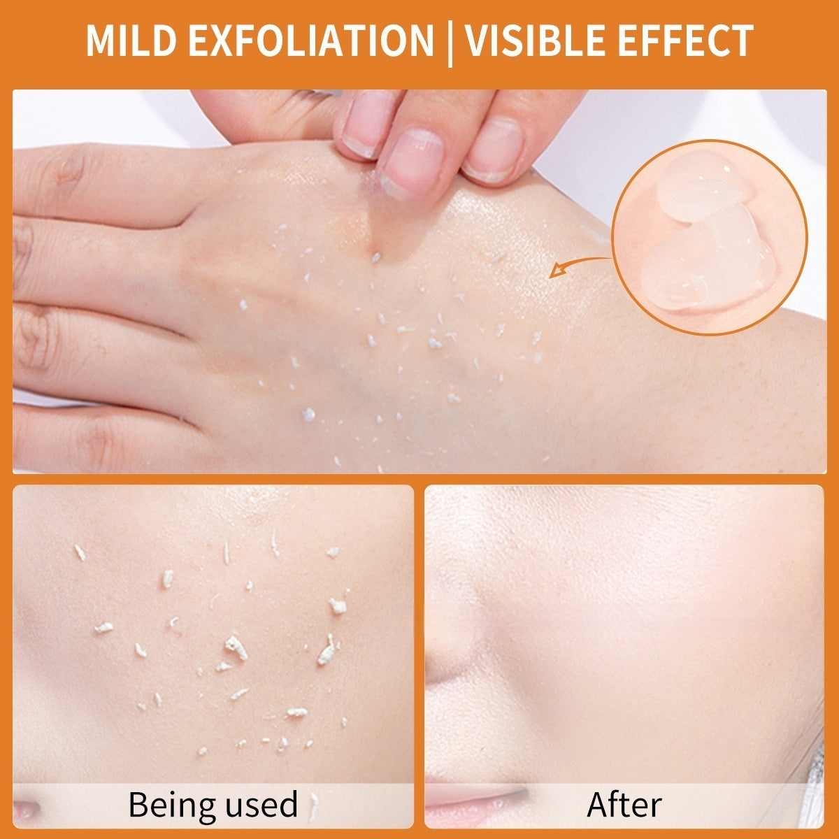 EnzyGlow™ Orange Enzyme Exfoliating Gel